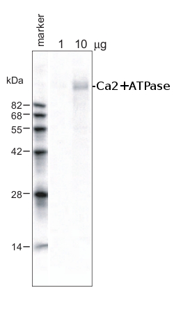 western blot using Ca2+ ATPase antibodies